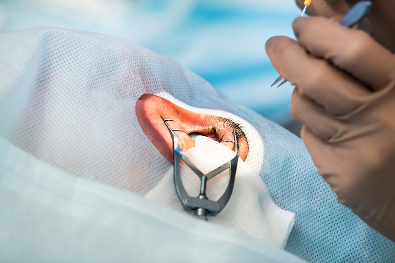 手術中に目が覚めますか?